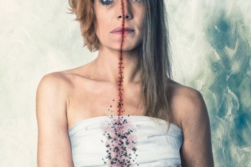 τα παράσιτα